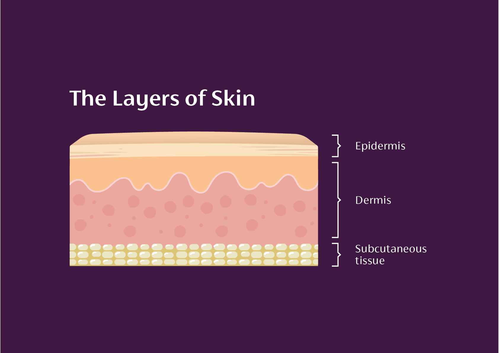 The layers of the skin: epidermis, dermis and subcutaneous tissue